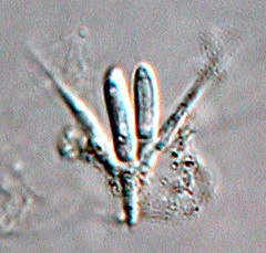 Tetracladium maxilliforme