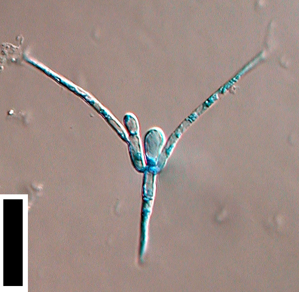 Tetracladium marchalianum