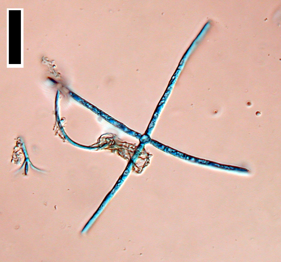 Lemonniera centrosphaera