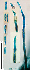 Cylindrotrichum clavatum