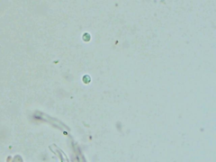 Steccherinum robustius