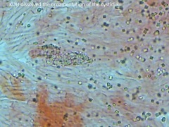 Steccherinum robustius