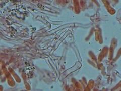 Steccherinum robustius