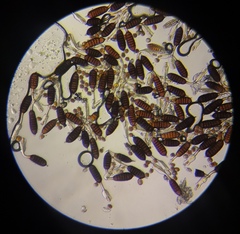 Phragmidium mucronatum