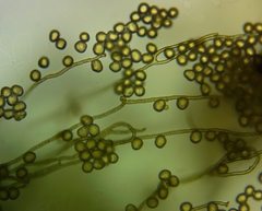 Hemitrichia leiotricha