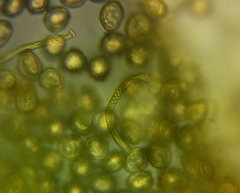 Hemitrichia leiotricha