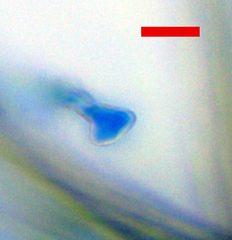 Erysiphe abbreviata