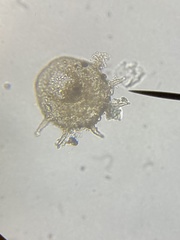 Centropyxis aculeata