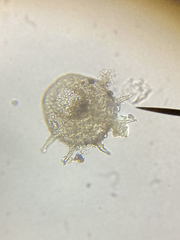 Centropyxis aculeata