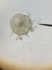 Centropyxis aculeata