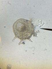 Centropyxis aculeata