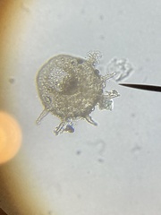 Centropyxis aculeata