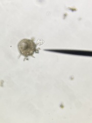 Centropyxis aculeata