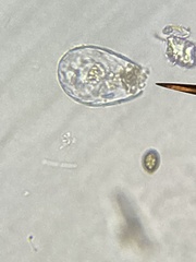Euglypha