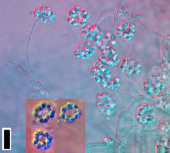 Hyaloscypha spinulosa