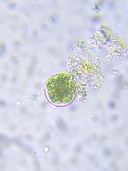 Chlorococcum