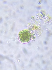 Chlorococcum