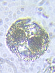 Staurastrum cerastes