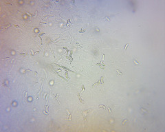 Myxarium nucleatum image