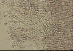Tarzetta cupularis