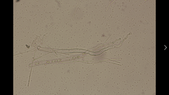 Tarzetta cupularis