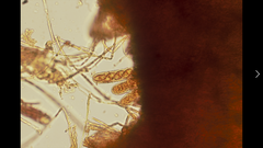 Tarzetta cupularis