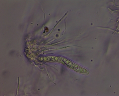 Arthopyrenia analepta