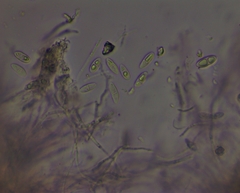 Arthopyrenia analepta