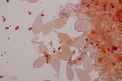 Leucoagaricus georginae