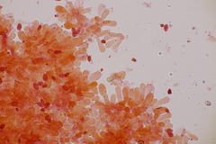 Leucoagaricus georginae