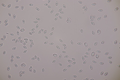 Leucoagaricus georginae