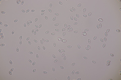 Leucoagaricus georginae