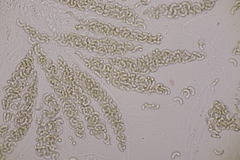 Diatrypella quercina