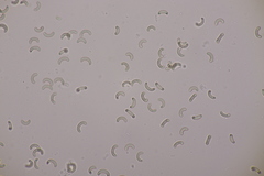 Diatrypella quercina