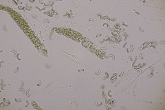 Diatrypella quercina