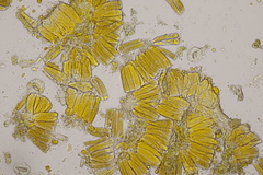 Melampsoridium betulinum