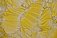 Melampsoridium betulinum