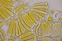 Melampsoridium betulinum