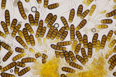 Phragmidium potentillae