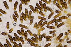 Phragmidium potentillae