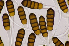 Phragmidium potentillae