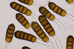 Phragmidium potentillae