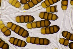 Phragmidium potentillae