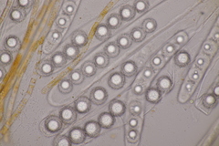 Lamprospora hispanica