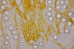 Lamprospora hispanica