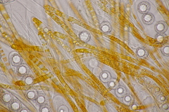 Lamprospora hispanica