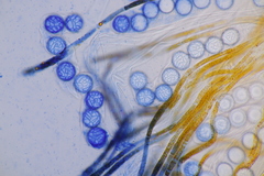 Lamprospora hispanica