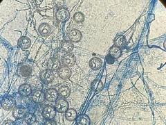 Pythium