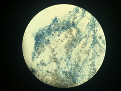 Pythium