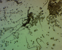 Trichia crateriformis